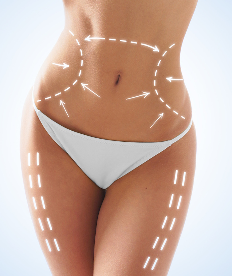 como-reducir-la-celulitis