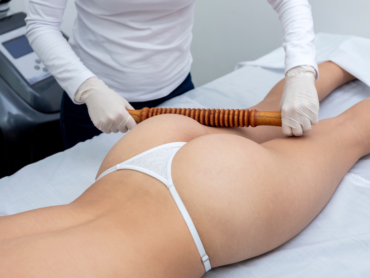 maderoterapia-en-alcorcon