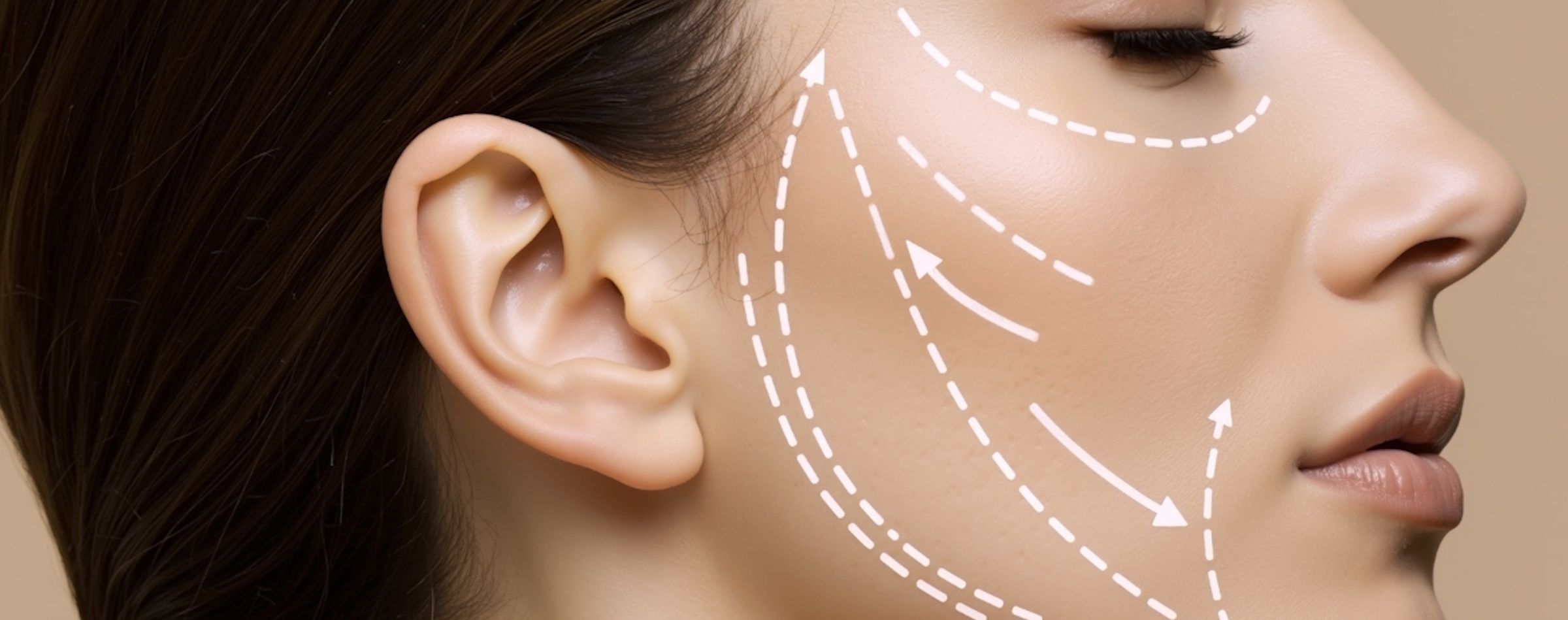 tratamiento_polinucleotidos_en_alcorcon